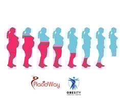 Slider image (8) Obesity Surgical Center | Dr. Jorge Reyes Mendiola